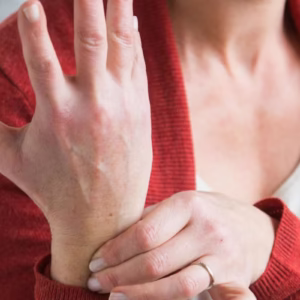 FIBROMYALGIE