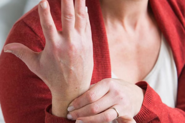 FIBROMYALGIE